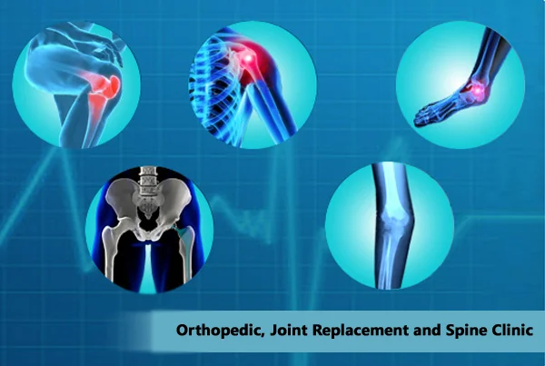 Joint Replacement
