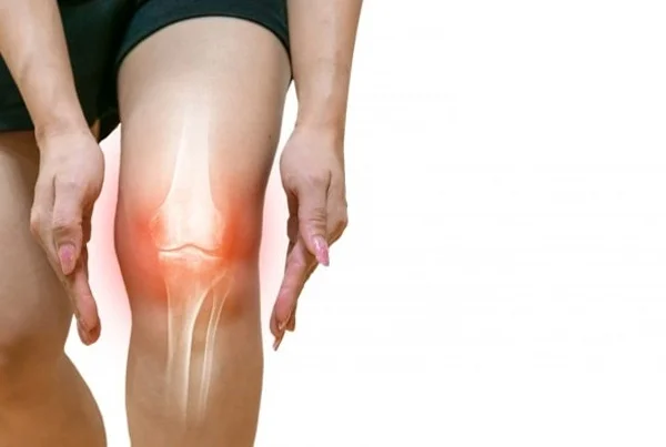 Knee Replacement